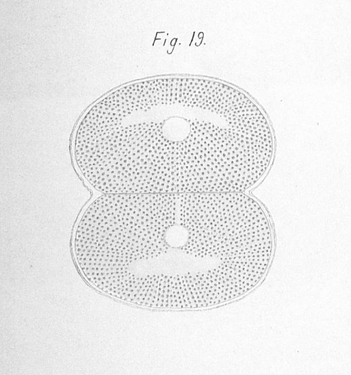 Ein Seeigel-Ei, noch ein paar wenige Minuten später, am Mikroskop gezeichnet von Oskar Hertwig 1875. [Bildquelle: Hertwig, Oscar, Beiträge zur Kenntniss der Bildung, Befruchtung und Theilung des thierischen Eies, in: Morphologisches Jahrbuch. Eine Zeitschrift für Anatomie und Entwicklungsgeschichte 1 (1876), Tafel XII.]